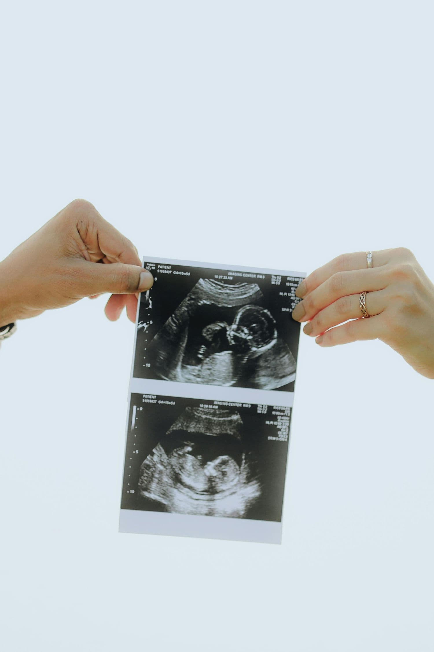 Patient holding an ultrasound image during fertility care