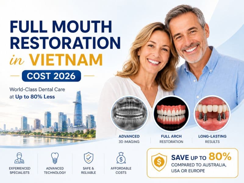 Full mouth restoration in Vietnam cost 2026 with up to 80% savings