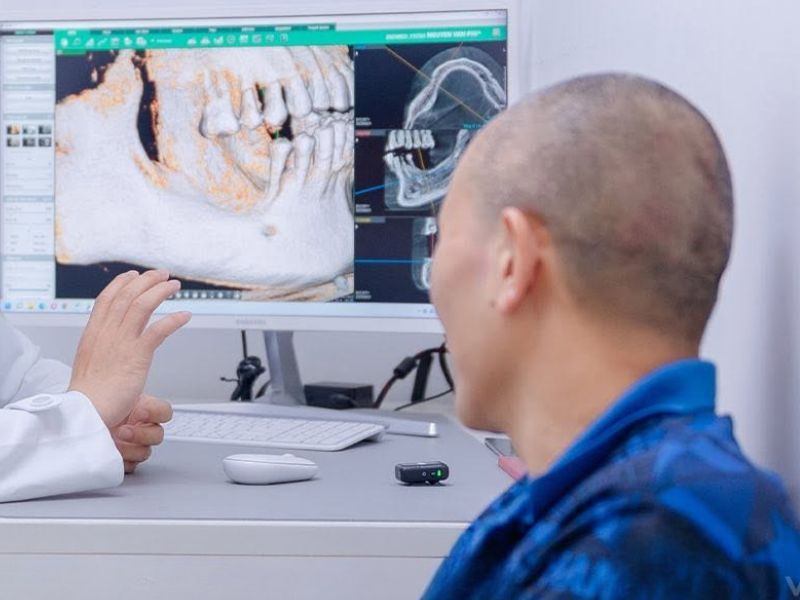 Dental Full Mouth Restoration in Vietnam