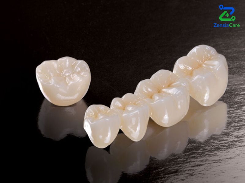 Zirconia Crowns and Bridges in Vietnam
